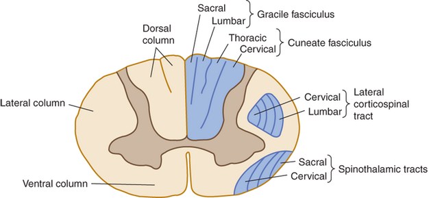 Dorsal Column Kypho